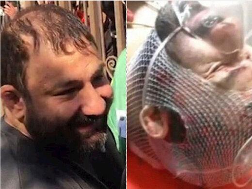 تصویر پشت در اتاق گنده لات تهران ، ویدئویی از شرایط هانی نموده پس از 12 ساعت جراحی