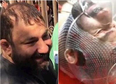 تصویر پشت در اتاق گنده لات تهران ، ویدئویی از شرایط هانی نموده پس از 12 ساعت جراحی